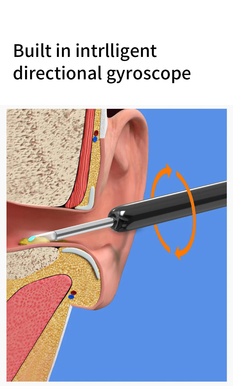 High-Precision Ear Wax Removal Tool – NE3 Ear Cleaner
