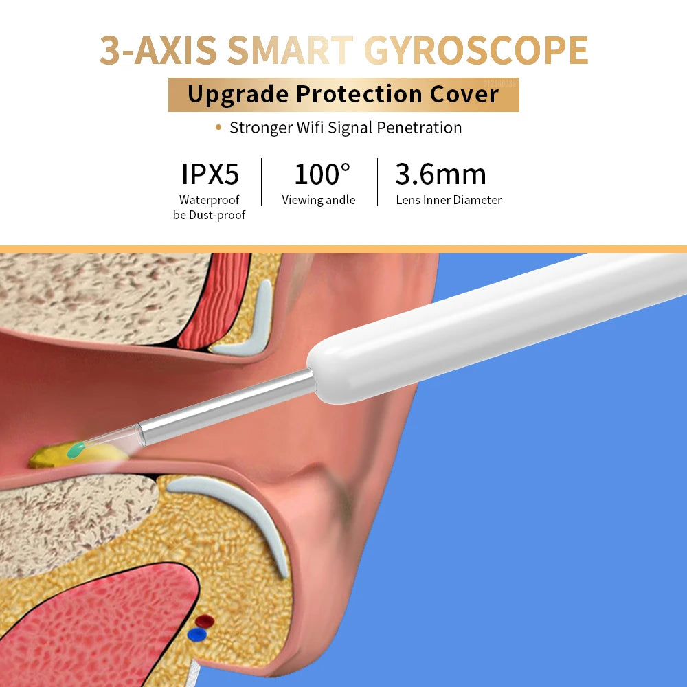 High-Precision Ear Wax Removal Tool – NE3 Ear Cleaner